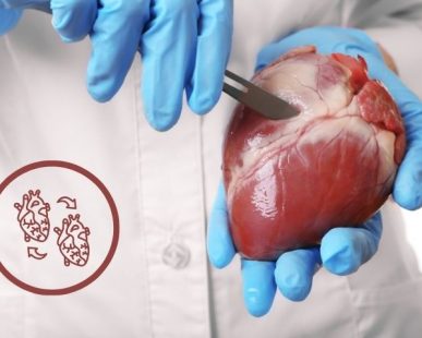 Is heart transplant in India really successful Heart Hospital in Delhi