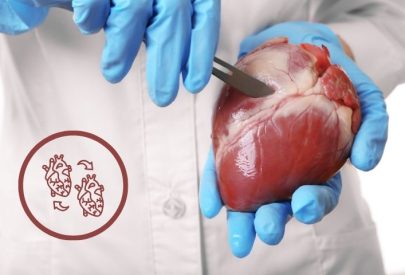 Is heart transplant in India really successful Heart Hospital in Delhi