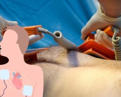 cardioversion surgery in Delhi