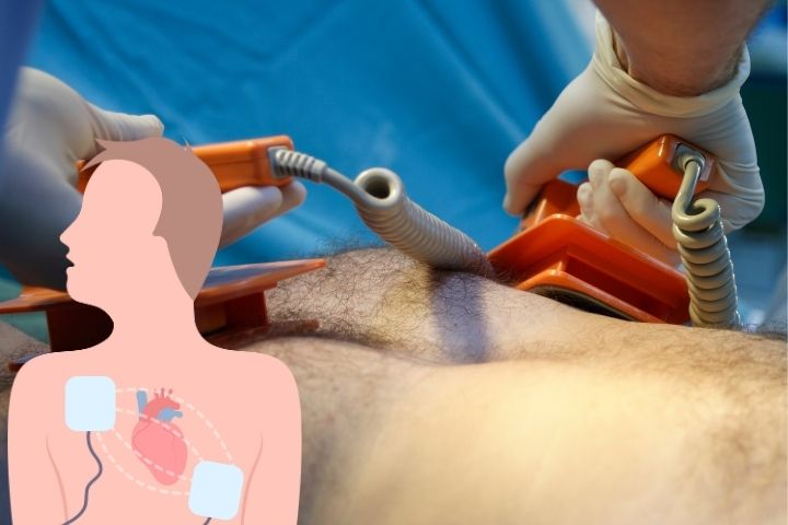 cardioversion surgery in Delhi