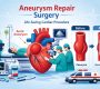Aneurysm repair surgery in Delhi at the best heart hospital 1 90x80