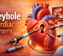 When is keyhole surgery recommended in a cardiac surgery hospital in Delhi 90x80