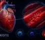 Myocarditis meaning heart treatment in delhi 90x80